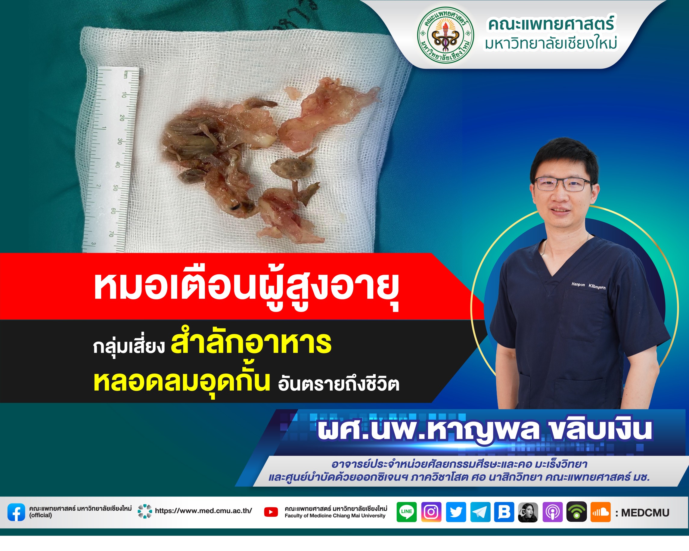 หมอเตือนผู้สูงอายุ กลุ่มเสี่ยงสำลักอาหารหลอดลมอุดกั้นอันตรายถึงชีวิต หมอเตือนผู้สูงอายุ กลุ่มเสี่ยงสำลักอาหารหลอดลมอุดกั้นอันตรายถึงชีวิต