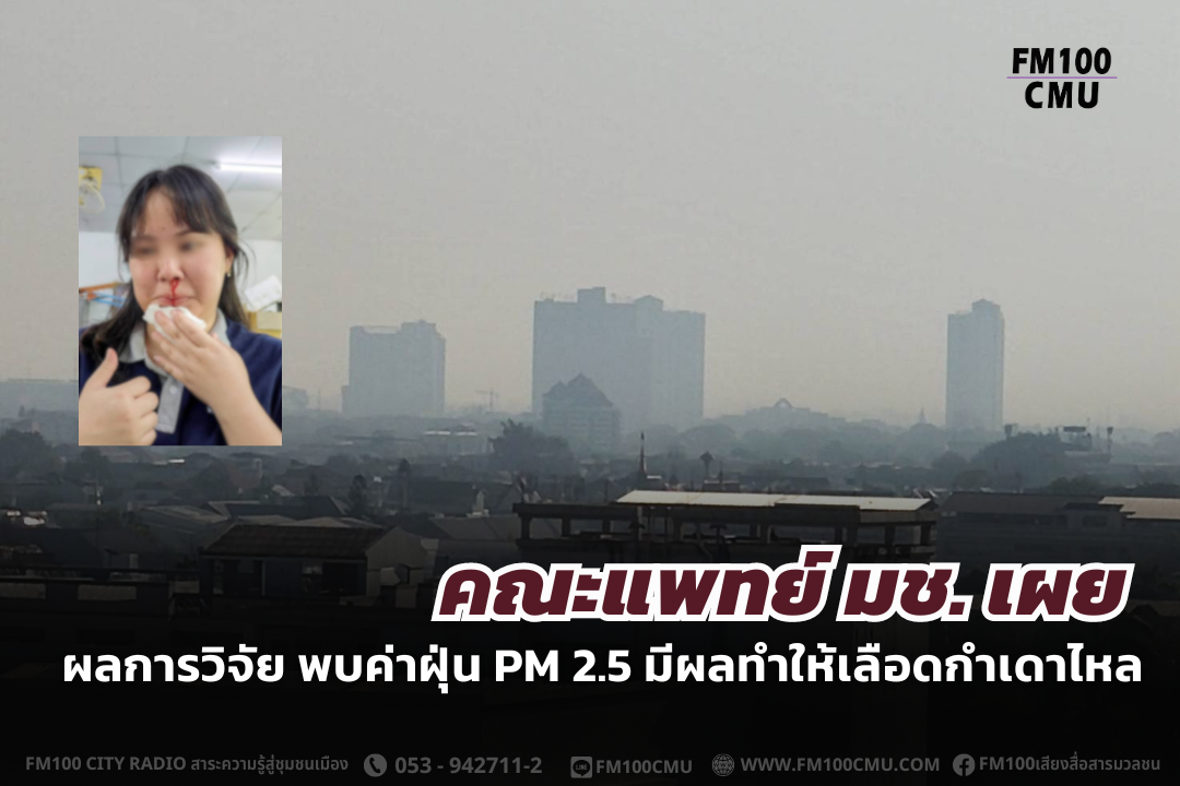 คณะแพทย์ มช. เผย ผลการวิจัย พบค่าฝุ่น PM 2.5 มีผลทำให้เลือดกำเดาไหล คณะแพทย์ มช. เผย ผลการวิจัย พบค่าฝุ่น PM 2.5 มีผลทำให้เลือดกำเดาไหล
